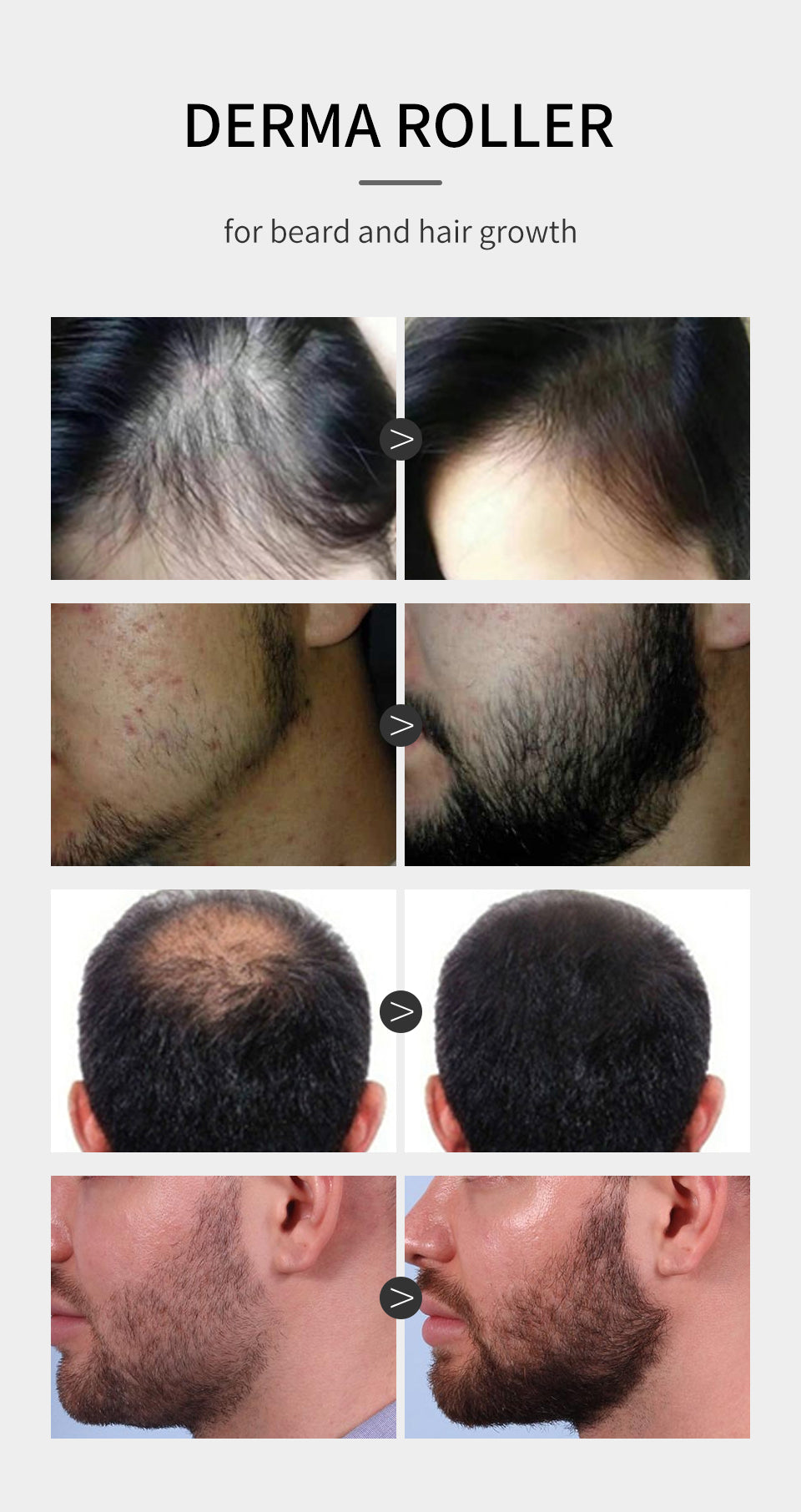 SEVICH Hair Growth Essence Spray